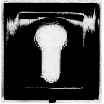 Uzlika PZ E8Y FB kvadrāta melns, E8